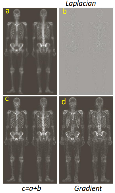 Sharpening laplacian filters